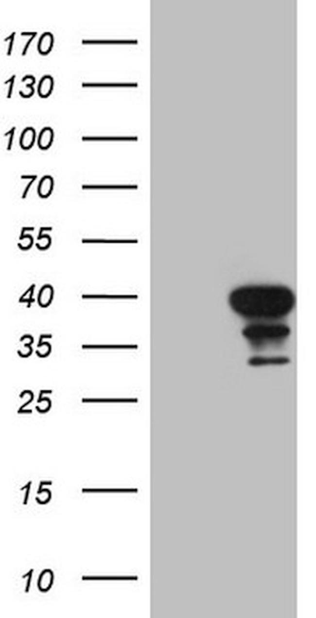 CDCA8 Antibody in Western Blot (WB)