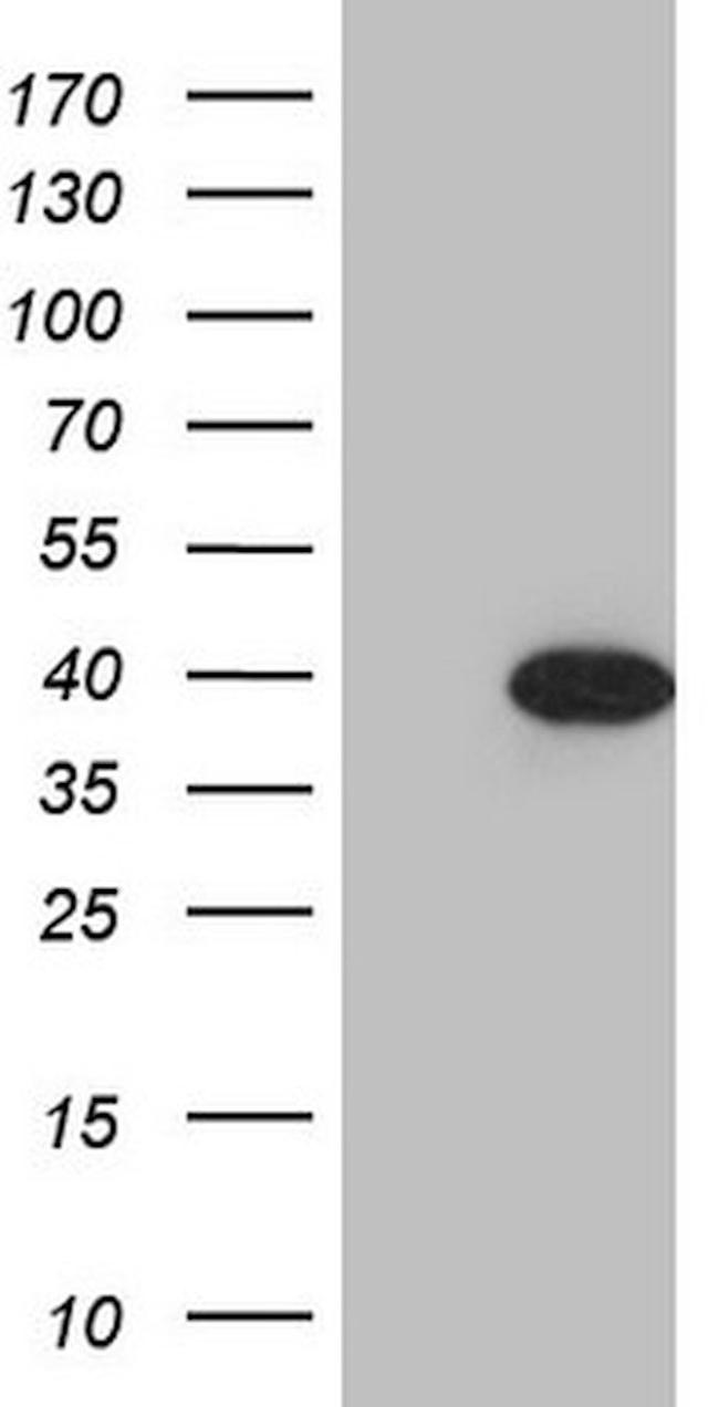 CDCA8 Antibody in Western Blot (WB)
