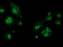 CDCP1 Antibody in Immunocytochemistry (ICC/IF)
