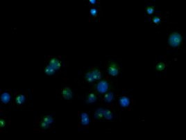 CDCP1 Antibody in Immunocytochemistry (ICC/IF)