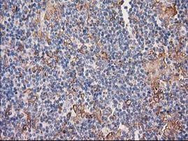 CDCP1 Antibody in Immunohistochemistry (Paraffin) (IHC (P))