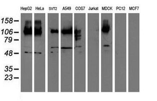 CDCP1 Antibody in Western Blot (WB)