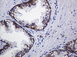 CDH1 Antibody in Immunohistochemistry (Paraffin) (IHC (P))