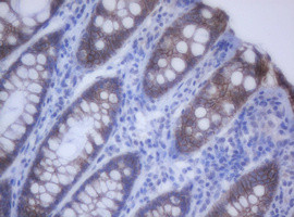 CDH1 Antibody in Immunohistochemistry (Paraffin) (IHC (P))