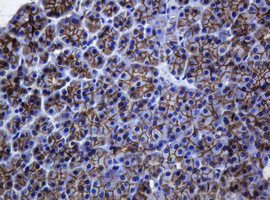 CDH1 Antibody in Immunohistochemistry (Paraffin) (IHC (P))
