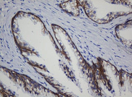 CDH1 Antibody in Immunohistochemistry (Paraffin) (IHC (P))