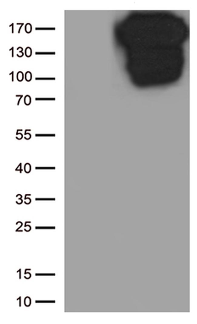 CDH1 Antibody in Western Blot (WB)