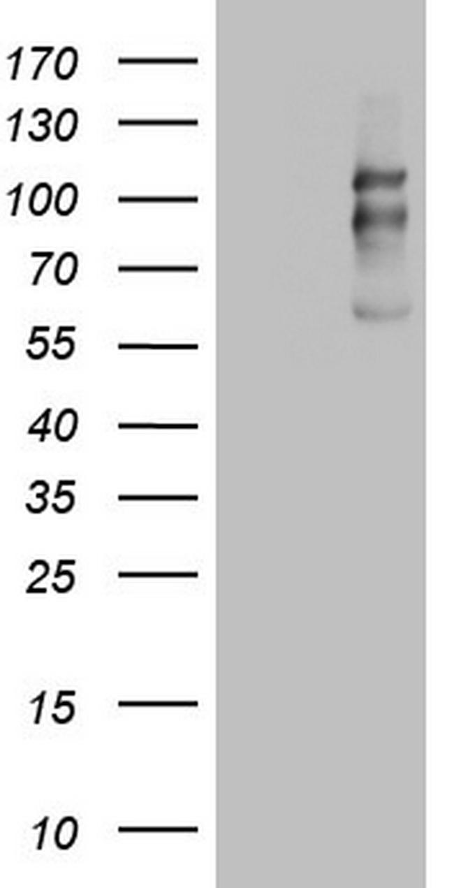 CDH1 Antibody in Western Blot (WB)