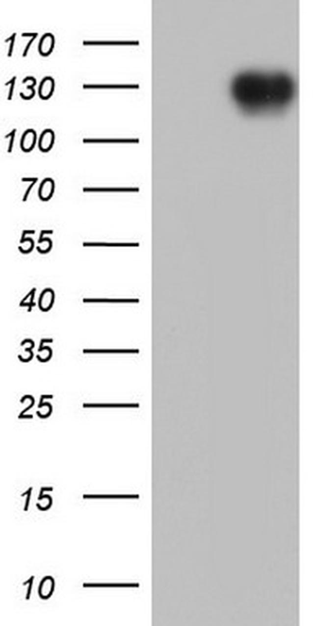 CDH2 Antibody in Western Blot (WB)