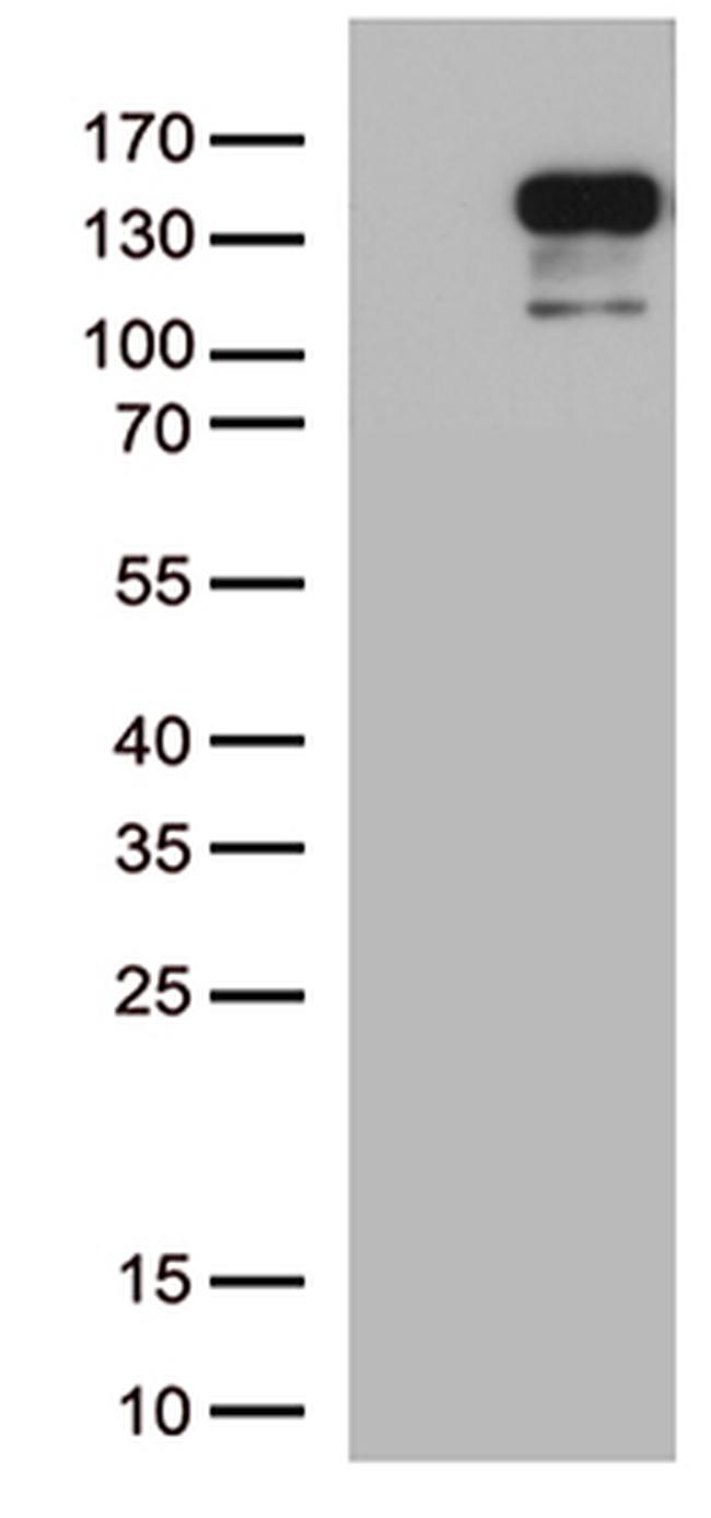 CDH2 Antibody in Western Blot (WB)