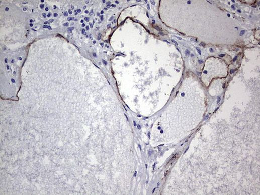 CDH4 Antibody in Immunohistochemistry (Paraffin) (IHC (P))