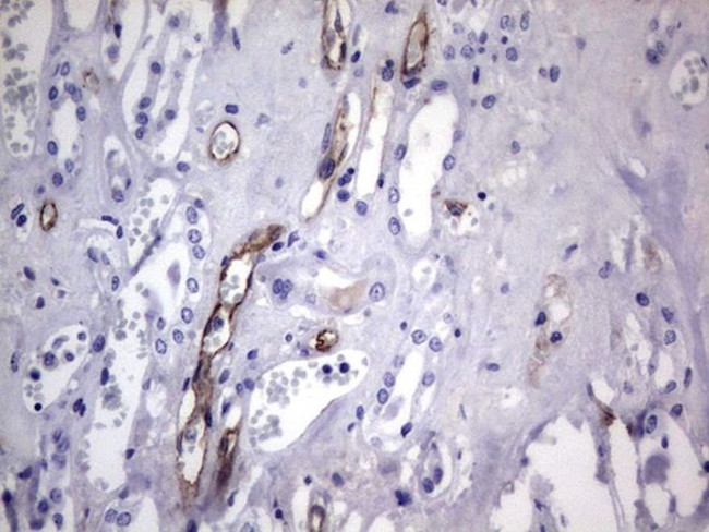 CDH4 Antibody in Immunohistochemistry (Paraffin) (IHC (P))