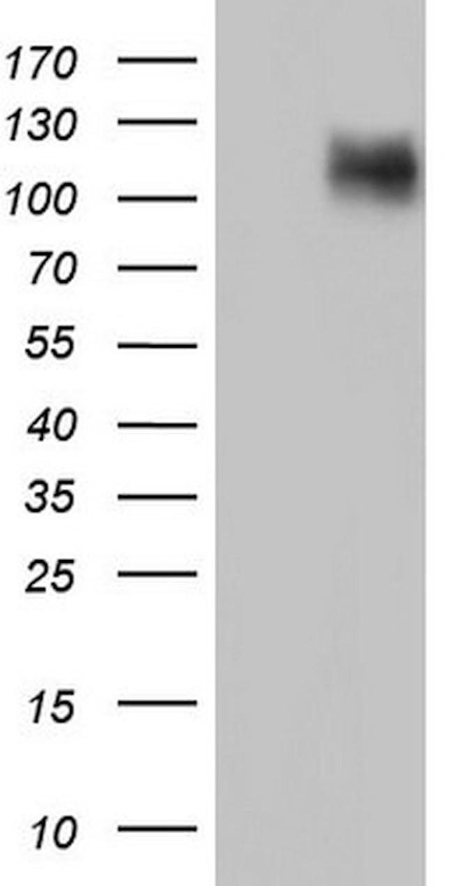 CDH4 Antibody in Western Blot (WB)