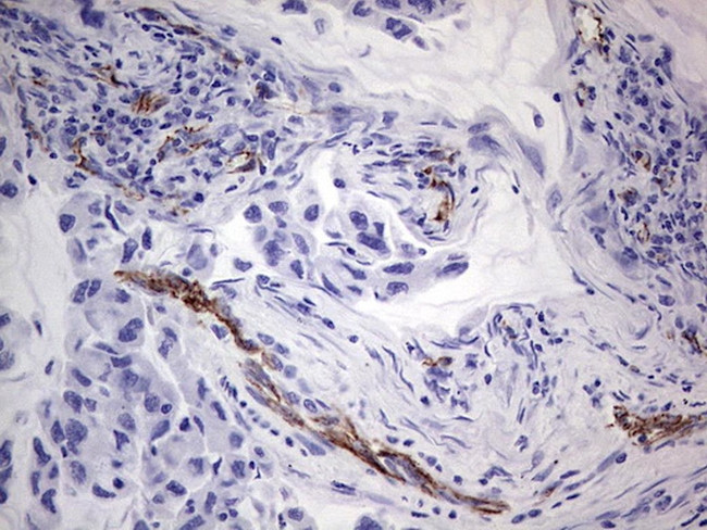 CDH5 Antibody in Immunohistochemistry (Paraffin) (IHC (P))