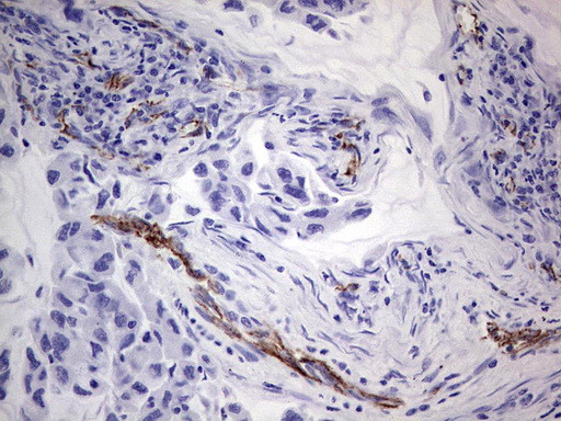 CDH5 Antibody in Immunohistochemistry (Paraffin) (IHC (P))