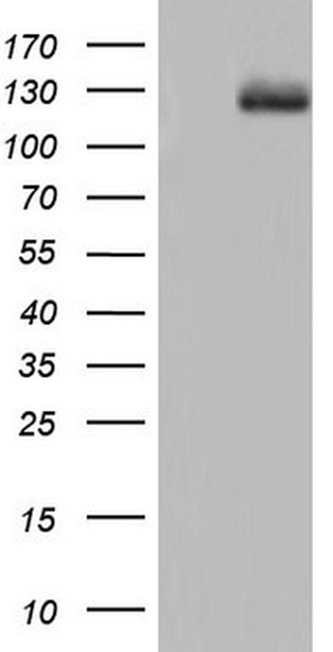 CDH5 Antibody in Western Blot (WB)