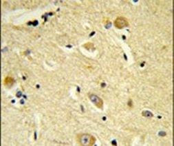 CDIPT Antibody in Immunohistochemistry (IHC)