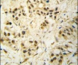 CDK1 Antibody in Immunohistochemistry (IHC)