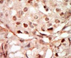 CDK10 Antibody in Immunohistochemistry (IHC)