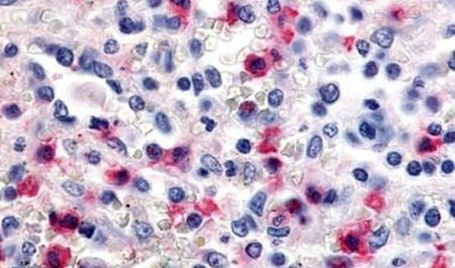 CDK12 Antibody in Immunohistochemistry (Paraffin) (IHC (P))