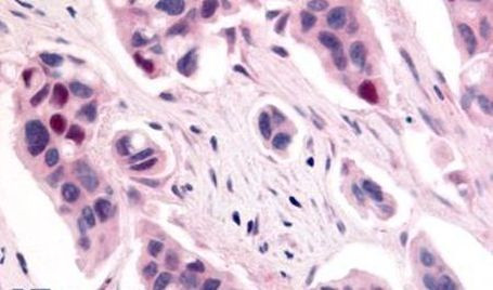 CDK12 Antibody in Immunohistochemistry (Paraffin) (IHC (P))