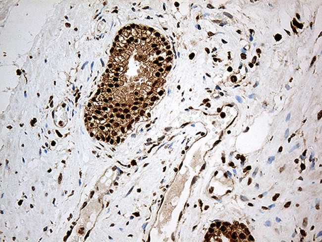CDK15 Antibody in Immunohistochemistry (Paraffin) (IHC (P))