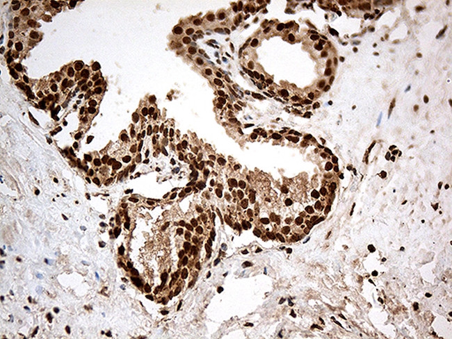 CDK15 Antibody in Immunohistochemistry (Paraffin) (IHC (P))