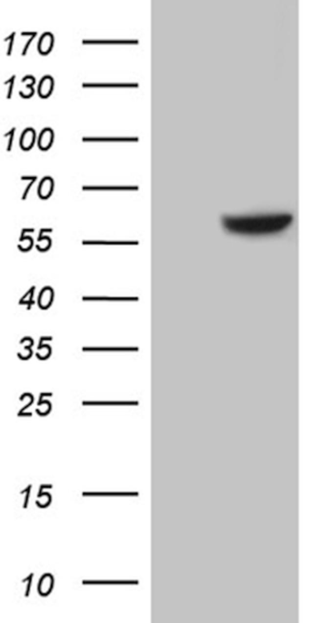 CDK17 Antibody in Western Blot (WB)