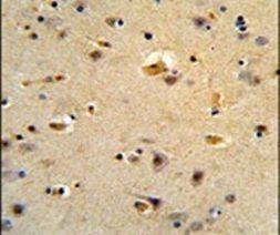 CDK5RAP1 Antibody in Immunohistochemistry (IHC)