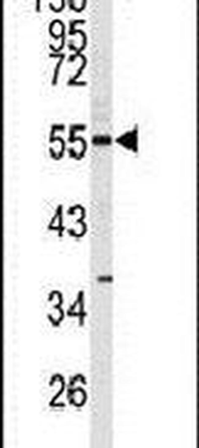 CDK8 Antibody in Western Blot (WB)