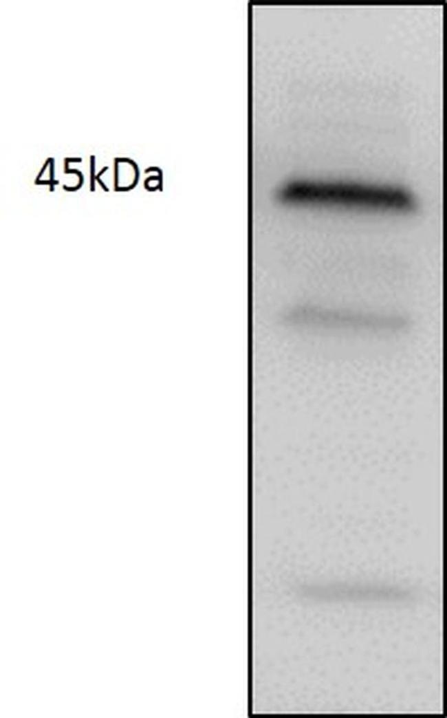 CDK9 Antibody in Western Blot (WB)