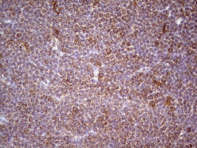 CDKL1 Antibody in Immunohistochemistry (Paraffin) (IHC (P))