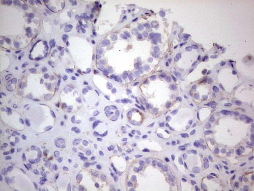 CDKL2 Antibody in Immunohistochemistry (Paraffin) (IHC (P))