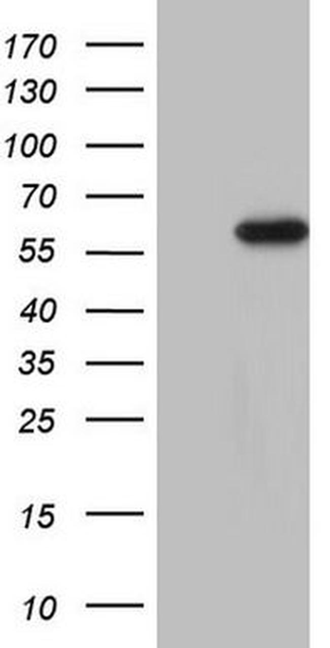 CDKL2 Antibody in Western Blot (WB)