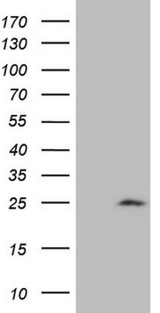 CDKN1A Antibody in Western Blot (WB)