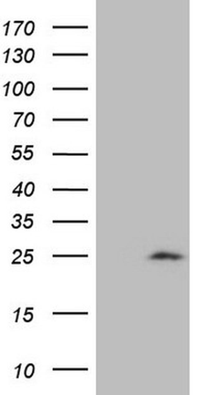 CDKN1A Antibody in Western Blot (WB)
