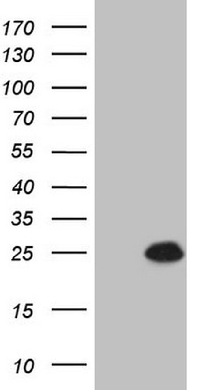 CDKN1A Antibody in Western Blot (WB)