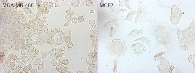 CDKN2A Antibody in Immunocytochemistry (ICC/IF)