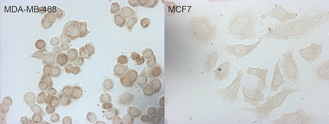 CDKN2A Antibody in Immunocytochemistry (ICC/IF)