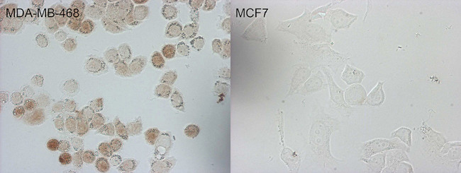 CDKN2A Antibody in Immunocytochemistry (ICC/IF)