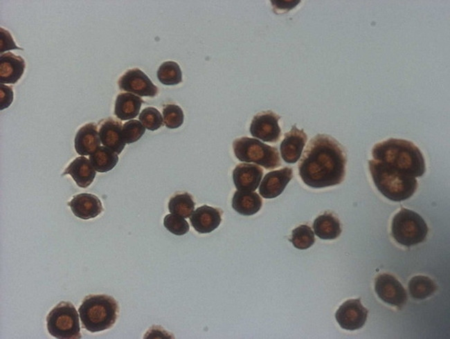 CDKN2A Antibody in Immunocytochemistry (ICC/IF)