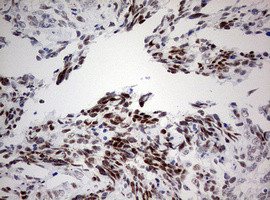 CDKN2A Antibody in Immunohistochemistry (Paraffin) (IHC (P))