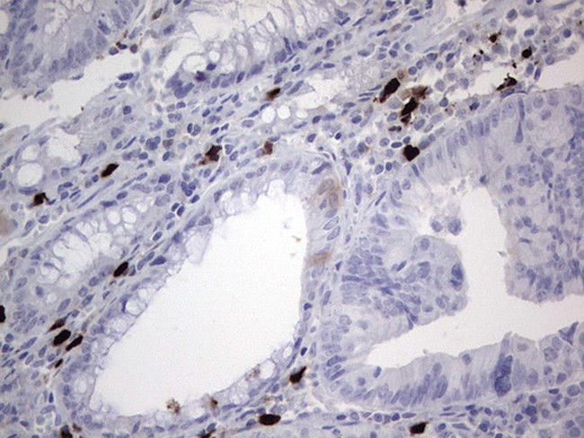 CDKN2A Antibody in Immunohistochemistry (Paraffin) (IHC (P))