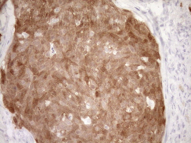CDKN2A Antibody in Immunohistochemistry (Paraffin) (IHC (P))
