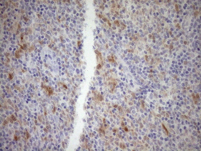 CDKN2A Antibody in Immunohistochemistry (Paraffin) (IHC (P))