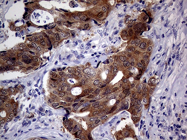CDKN2A Antibody in Immunohistochemistry (Paraffin) (IHC (P))