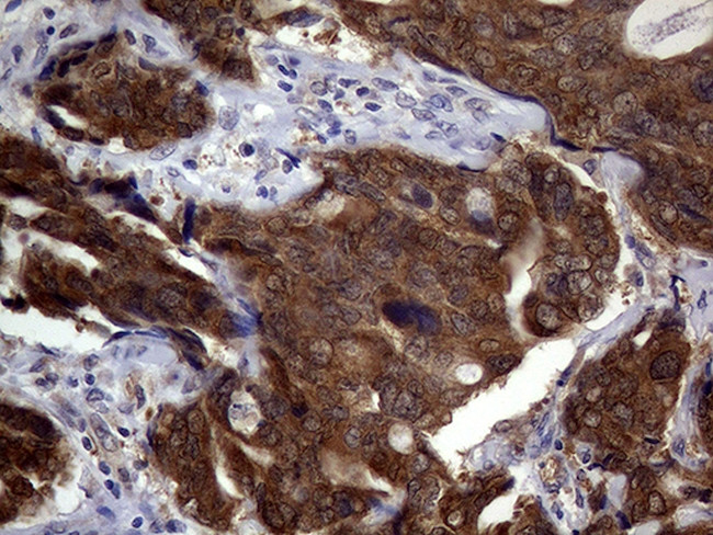 CDKN2A Antibody in Immunohistochemistry (Paraffin) (IHC (P))