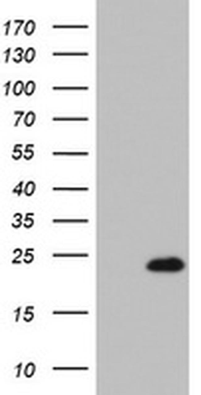 CDKN2A Antibody in Western Blot (WB)