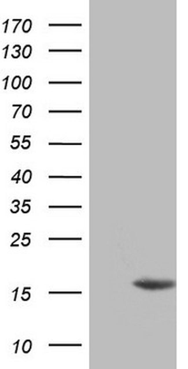 CDKN2A Antibody in Western Blot (WB)