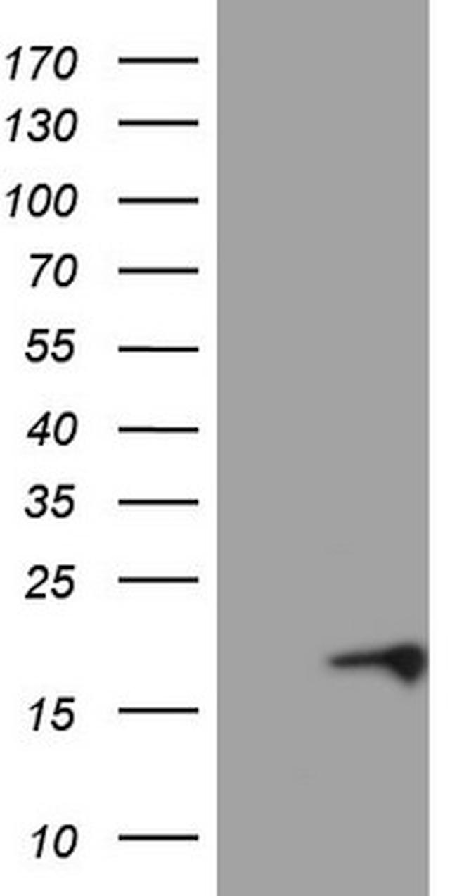 CDKN2A Antibody in Western Blot (WB)